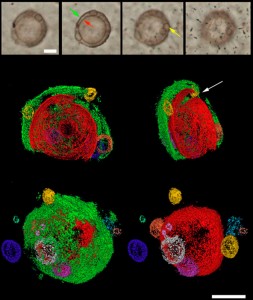 Figure 2 — The fossil Eosphaera tyleri from the Gunflint chert, Ontario, Canada. The top panel shows the fossil using conventional microscopy. The images below show a 3D reconstruction of this complex fossil, which consists of two large spheres and a number of smaller ones. Scale bars are 10 micrometres. Modified from Brasier et al. (2015).